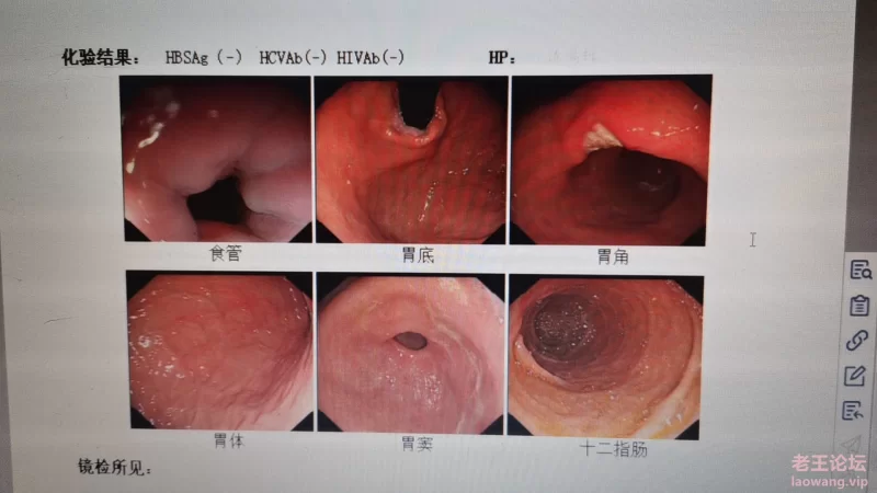 为保证患者隐私，请各位老王文明探讨。请勿下载，谢谢！